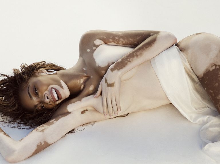 model winnie harlow lying down, smiling, wearing a wrap around waist, and holding her hand and arm over upper body